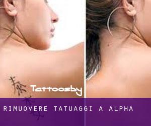 Rimuovere Tatuaggi a Alpha
