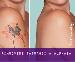 Rimuovere Tatuaggi a Alphaba