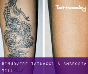 Rimuovere Tatuaggi a Ambrosia Mill