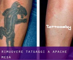 Rimuovere Tatuaggi a Apache Mesa