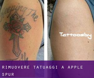 Rimuovere Tatuaggi a Apple Spur