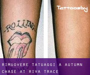 Rimuovere Tatuaggi a Autumn Chase at Riva Trace