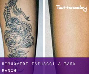 Rimuovere Tatuaggi a Bark Ranch