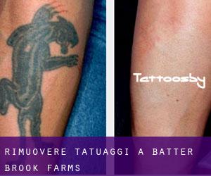 Rimuovere Tatuaggi a Batter Brook Farms