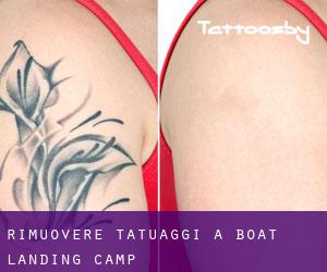 Rimuovere Tatuaggi a Boat Landing Camp