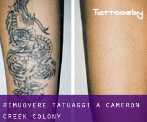 Rimuovere Tatuaggi a Cameron Creek Colony