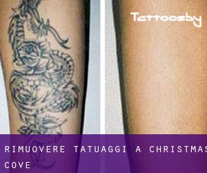 Rimuovere Tatuaggi a Christmas Cove