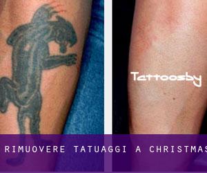 Rimuovere Tatuaggi a Christmas