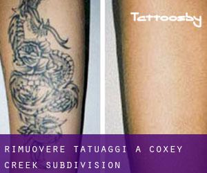 Rimuovere Tatuaggi a Coxey Creek Subdivision