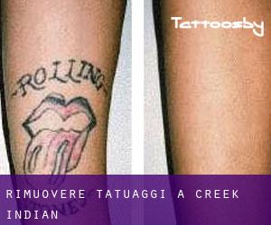 Rimuovere Tatuaggi a Creek Indian