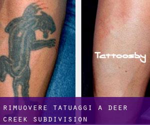 Rimuovere Tatuaggi a Deer Creek Subdivision