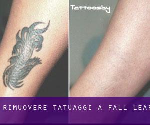 Rimuovere Tatuaggi a Fall Leaf