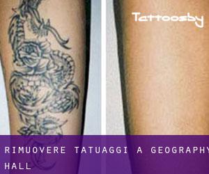 Rimuovere Tatuaggi a Geography Hall