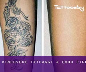 Rimuovere Tatuaggi a Good Pine