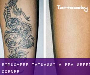 Rimuovere Tatuaggi a Pea Green Corner
