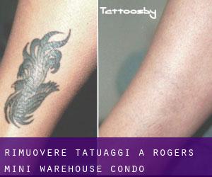 Rimuovere Tatuaggi a Rogers Mini Warehouse Condo