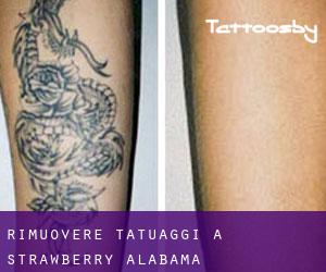 Rimuovere Tatuaggi a Strawberry (Alabama)