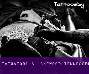 Tatuatori a Lakewood (Tennessee)