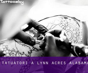 Tatuatori a Lynn Acres (Alabama)