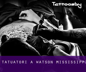 Tatuatori a Watson (Mississippi)