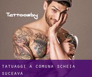 tatuaggi a Comuna Scheia (Suceava)