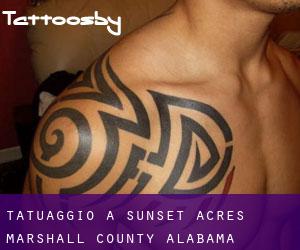 tatuaggio a Sunset Acres (Marshall County, Alabama)