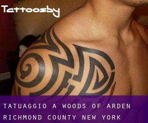 tatuaggio a Woods of Arden (Richmond County, New York)