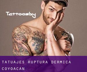 Tatuajes Ruptura Dérmica (Coyoacán)